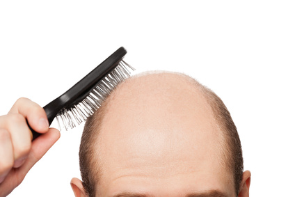 5 Most common reasons for Hair Fall – Do You Find Your Culprit here?