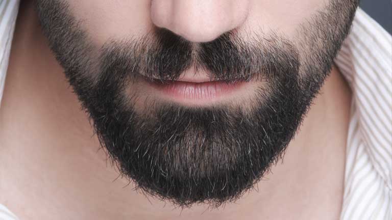 How much does a beard transplant costs?