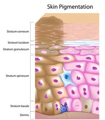 Pigmentation Treatment