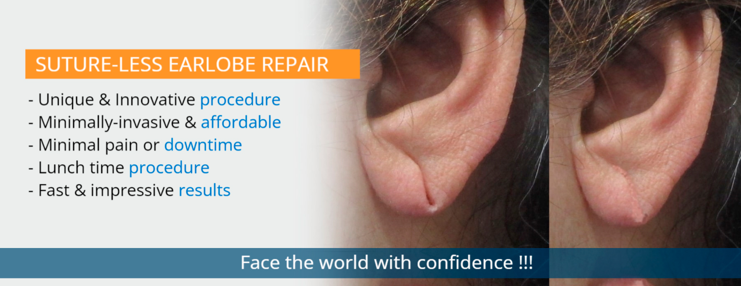 Earlobe Repair without Stitches  Earlobe repair at Aura Skin