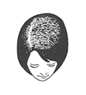 Female-Pattern Hair-Loss Grade 1