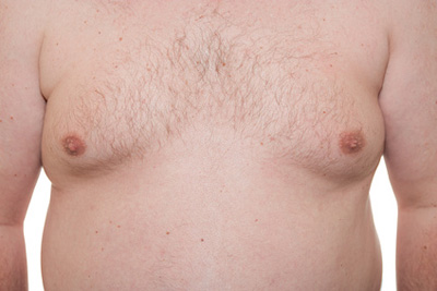 Male Chest Fat